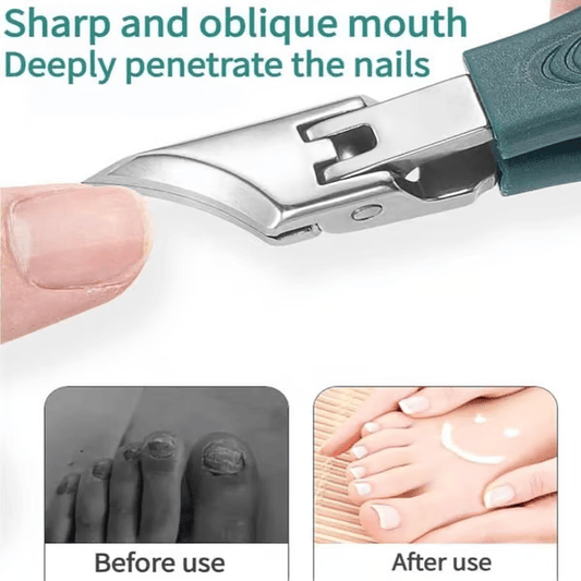 🔥 Premium 3-Piece Eagle Beak Nail Clipper Set